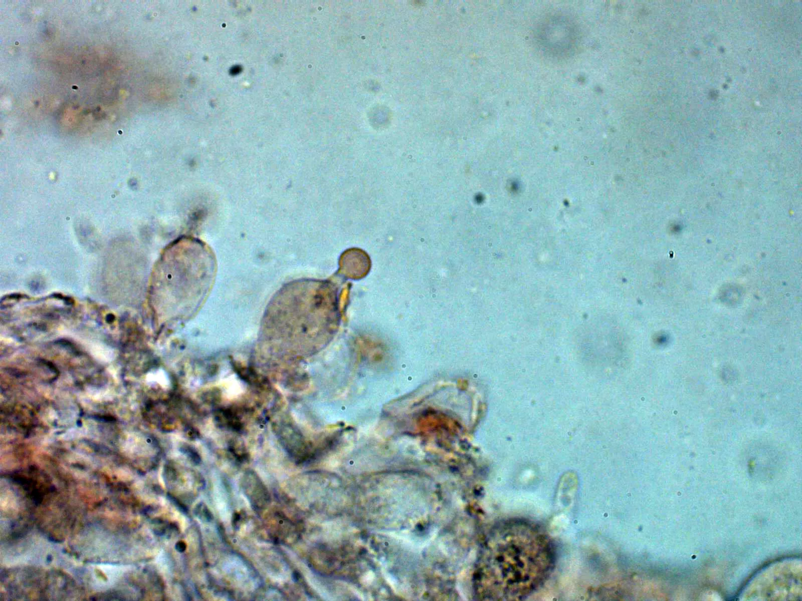 10 - Queilocistidio 4
